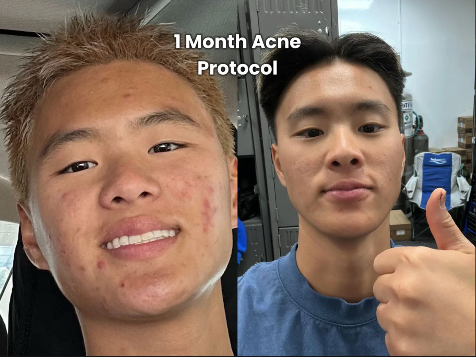 Member skin transformation